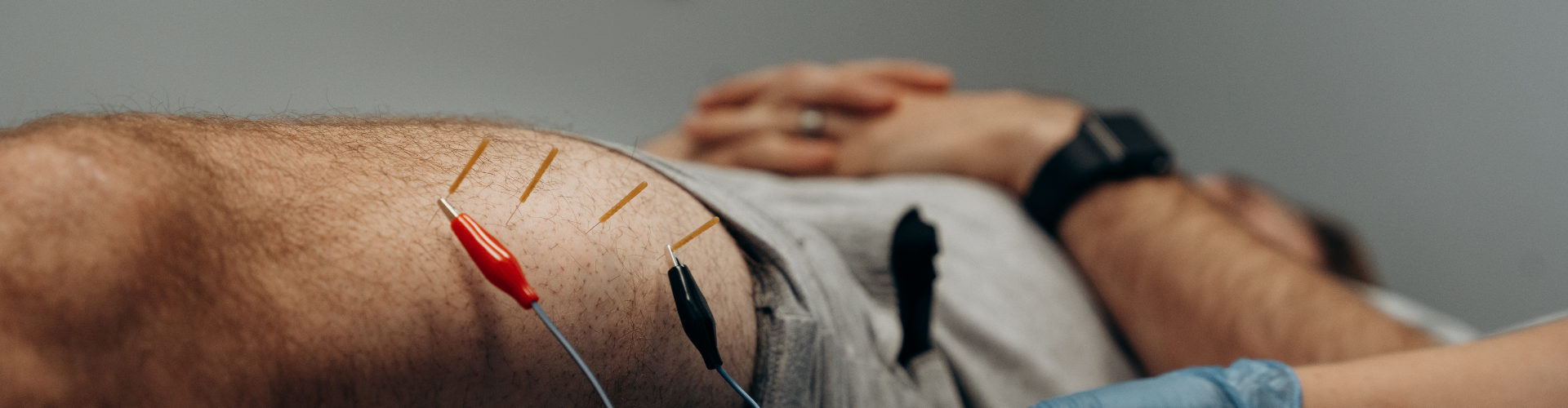 Dry Needling